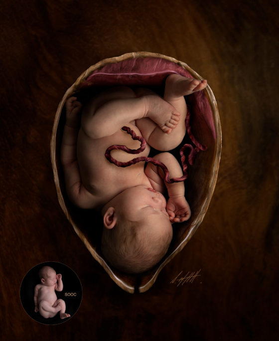 Womb Placenta & Umbillical Cord